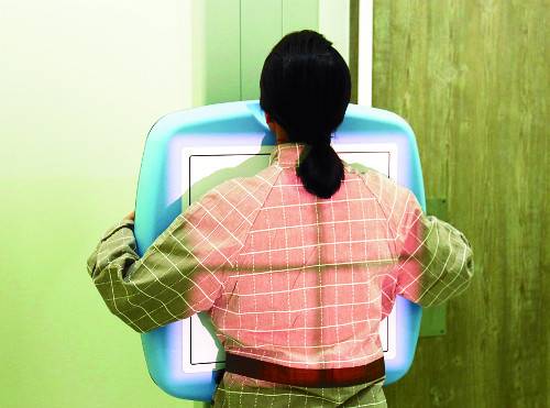 유방촬영술 장면. 국민일보DB