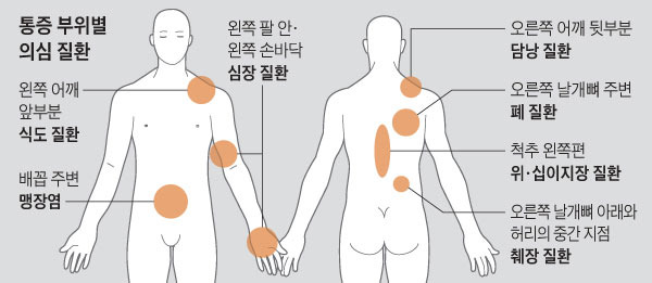 사진=헬스조선DB