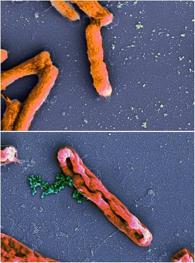 건강한 대장균(위)과 항균 펩타이드에 의해 사멸한 대장균의 모습. /JBC