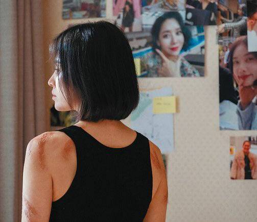 학교폭력 고발 메시지를 전면으로 내세운 넷플릭스 드라마 더글로리, 주인공 문동은의 몸에는 고데기 학폭으로 인한 화상 흔적이 곳곳에 남아있다(사진=넷플릭스)