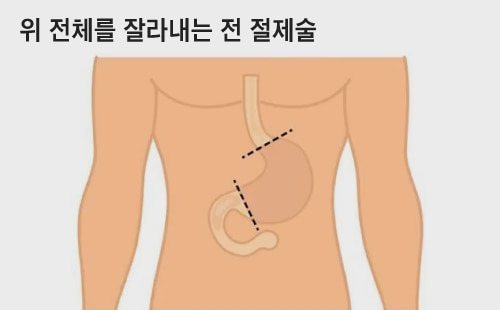 /자료=서울대병원