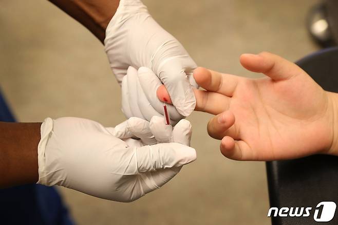 HIV 검사모습 ⓒ AFP=뉴스1