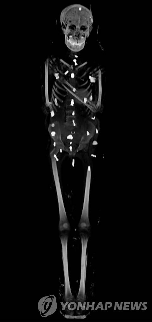 황금 소년 미라 CT 사진 (EPA=연합뉴스) 2천300년된 황금 소년 미라 컴퓨터단층촬영(CT) 사진이 24일(현지시간) 공개됐다. 2023.1.24  [재판매 및 DB 금지]
