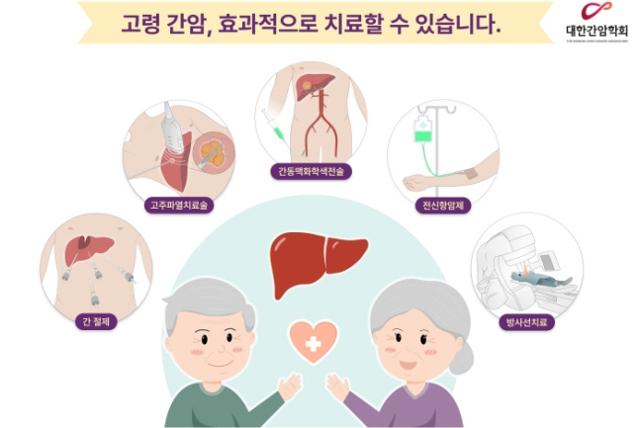 대한간암학회 제공