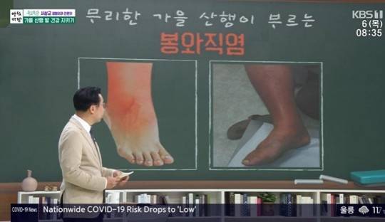 경기장에 있던 ‘개똥’ 때문에 봉와직염에 걸려 다리 절단 위기에 놓인 럭비 선수 사연이 전해졌다. 봉와직염 이미지(위 기사와 관련 없는 방송 사진). KBS