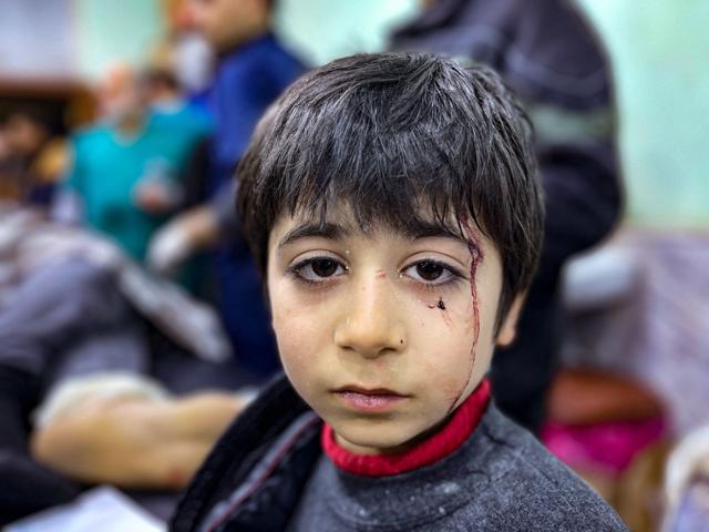 6일 시리아 이들리브주의 한 병원에서 규모 7.8의 강진으로 다친 소년이 치료를 기다리고 있다. 이들리브=AFP 연합뉴스
