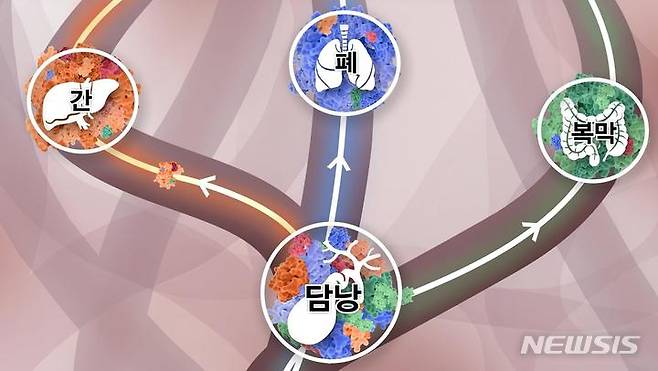 [성남=뉴시스] 담낭에 다양한 클론들이 섞여 있다가, 주황색 클론이 이긴 암세포는 간으로, 파란색 클론이 이긴 암세포는 폐로, 초록색 클론이 이긴 암세포는 복막으로 간다(연구사진)