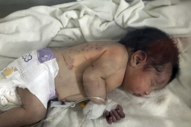 구출된 신생아의 모습. AP연합뉴스