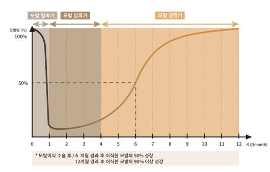 모발이식 주기 그래프ㅣ출처: 뉴헤어의원