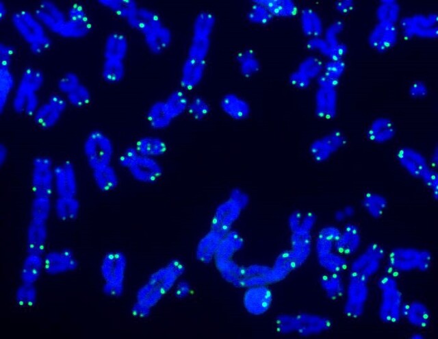 텔로미어는 세포가 분열할 때 서로 다른 염색체들이 섞이지 않도록 조절하고 염색체의 끝이 손상되지 않도록 보호하는 역할을 한다. 이미지는 DNA 복구 활동이 이뤄질 때의 텔로미어(녹색)와 DNA(파란색)의 모습. 사진제공=솔트연구소