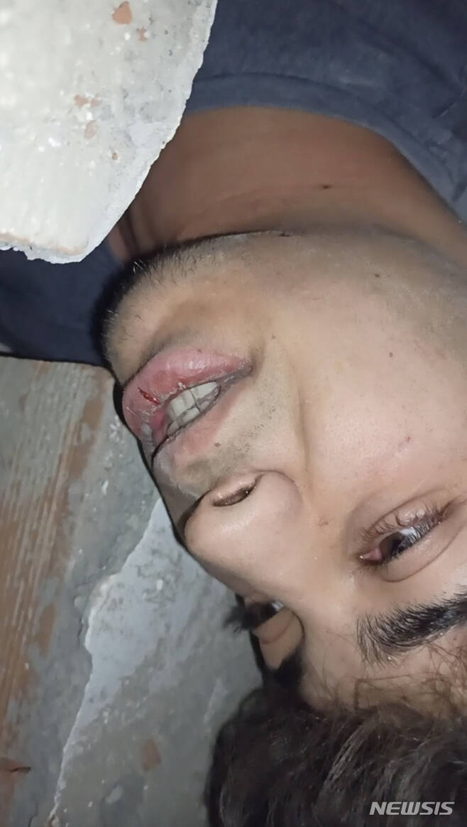 [아디야만( 튀르키예)= AP/뉴시스]  튀르키예 17세 소년 타하 에르뎀이 2월6일 지진 발생으로 무너진 아디야만 시내 아파트 건물잔해 밑에 깔린채 촬영한 휴대전화기 유언 동영상의 일부.