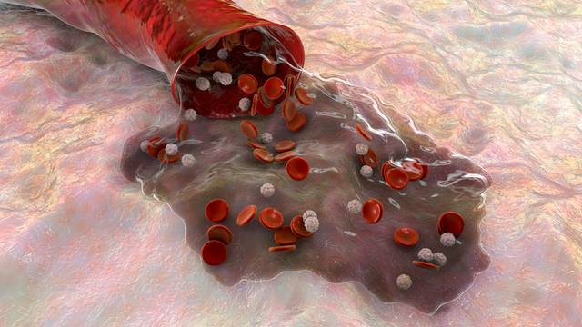 이상지질혈증 유병자의 절반 이상이 신체활동 부족 상태로 나타났다. 게티이미지뱅크