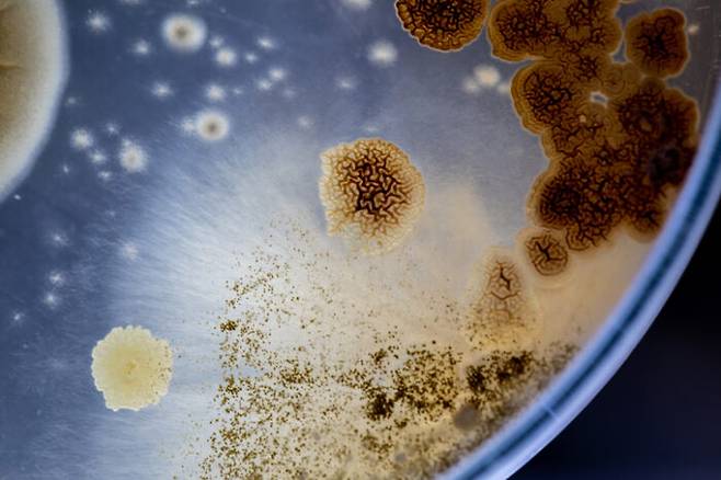 우리 몸에도 효모가 산다. 칸디다라는 이 효모가 과하게 자라면 피부나 발, 입, 음경, 질 등에 효모 감염이 생길 수 있다. [사진=게티이미지뱅크]