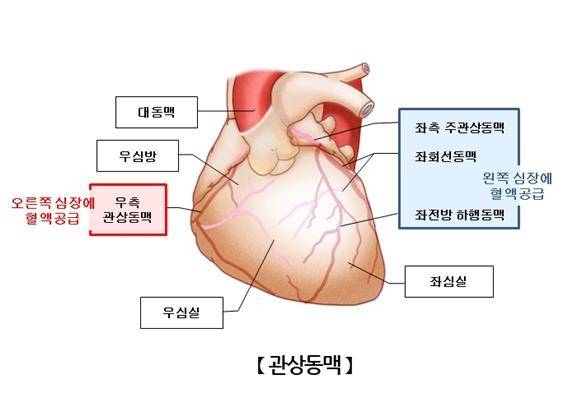 관상동맥 [출처: 서울아산병원]