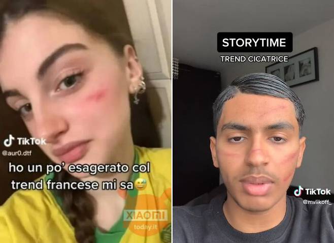이탈리아 청소년들이 얼굴에 흉터를 만든 뒤 동영상 플랫폼을 통해 공유하고 있다. [사진=온라인 커뮤니티]