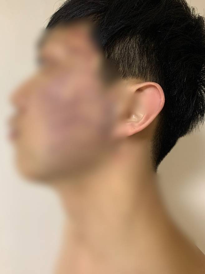 '감금폭행' 당시 피해자 중 1명의 얼굴11