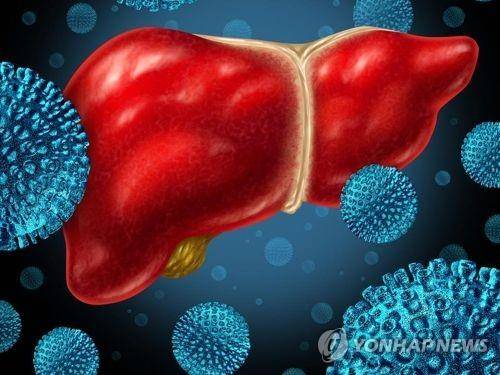 간염 [게티이미지뱅크 제공]