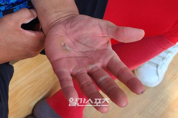 검게 그을린 얼굴과 굳은살은 노력의 결과물이다. IS포토