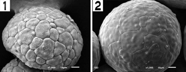 ① 경쟁사가 개발 중인 마그네시아의 전자현미경 사진. 표면이 거친 것은 수분과 반응했기 때문이다. 모양도 구형이 아닌 타원형에 
가깝다. 모두 품질을 떨어뜨리는 요소다. ② 소울머티리얼의 엑시알 사진. 표면이 습기와 반응하지 않아 매끈하고, 모양은 구형에 
가깝다. 소울머티리얼 제공