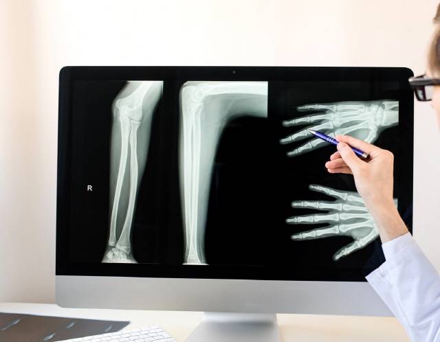 어린이의 뼈 나이 검사는 성장장애 관련 질환의 경과 관찰 등에 활용할 수 있다.  /게티이미지뱅크