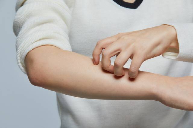 스트레스는 피부가 가려움을 느끼는 신경섬유를 활성화시켜 가려움을 유발한다./사진=게티이미지뱅크