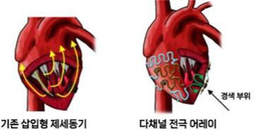 서울대병원 제공