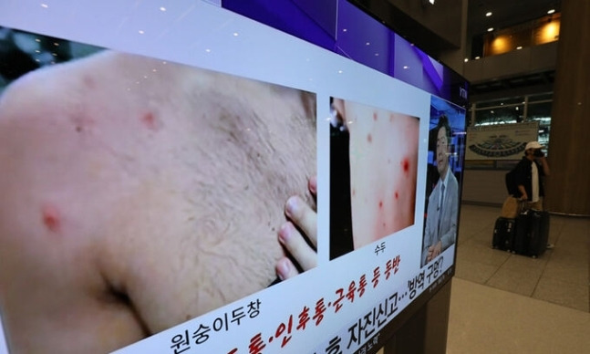 지난 2022년 인천공항 제1터미널 입국장 TV에 원숭이두창 관련 뉴스가 나오고 있다. 뉴스1