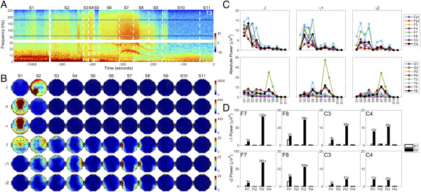 미시간대 연구팀이 발표한 뇌파 자료. PNAS