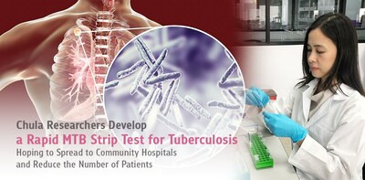 Chula Researchers Develop Rapid MTB Strip Test for Tuberculosis