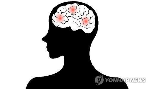 뇌졸중 [제작 박이란]