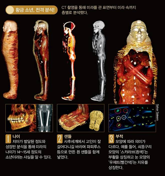 CT 촬영을 통해 미라를 관 표면부터 미라 속까지 층별로 분석했다.Sahar Saleem