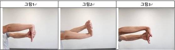 엘보 발생했을 때 도움되는 스트레칭법. 사진 서울대병원.