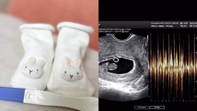타히티 출신 지수가 임신 소식을 알렸다. 사진| 신지수 SNS
