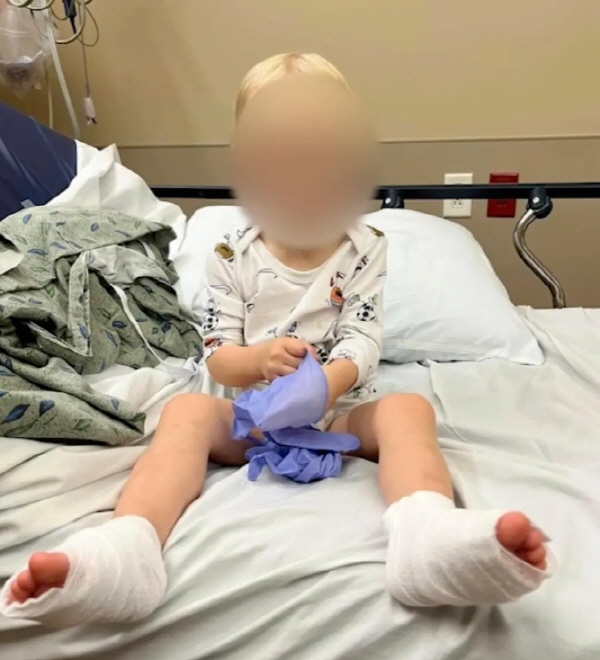 미국 애리조나에 거주 중인 생후 18개월 아기 메이슨은 최근 발바닥 화상을 입은 뒤 치료를 받았다. / 사진= 뉴욕포스트
