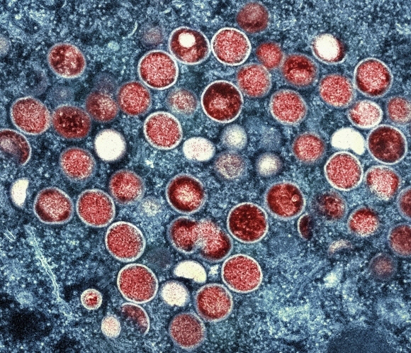 ▲ 미 국립 알레르기·전염병연구소(NIAID)가 전자현미경으로 촬영한 뒤 색처리한 엠폭스(MPOX·옛 명칭 원숭이두창)에 감염된 세포. 감염된 세포(파란색) 내에 엠폭스 입자(빨간색)가 보인다. [연합뉴스 자료사진]