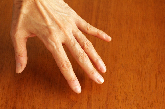 손등 핏줄이 튀어나오는 ‘손등 정맥류’는 혈액순환이 원활하지 않아 손끝에 피가 몰릴 때 발생한다./사진=게티이미지뱅크