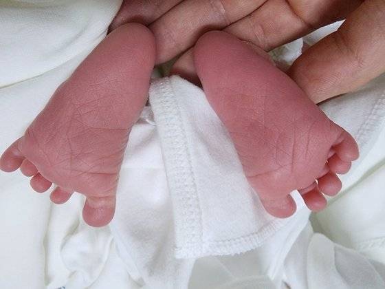 지난 12일 태어난 최씨의 아들 발 사진. 최씨 제공