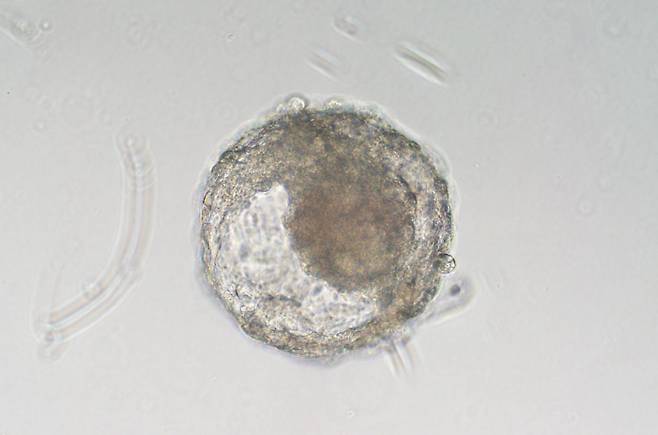 중국 연구진이 만든 원숭이 배반포 유사체(blastoid). 원숭이 배아줄기세포로 만들었다. 일종의 인공 수정란인 원숭이 배반포 유사체는 사람을 대신해 배아 발생과정과 불임 원인을 찾는 연구에 활용할 수 있다./Zhen Lieu