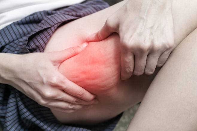 울퉁투불 셀룰라이트를 줄이는 데 도움이 되는 식품들을 알아본다. [사진=게티이미지뱅크]