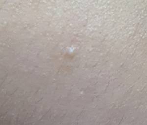 사진=헬스조선DB