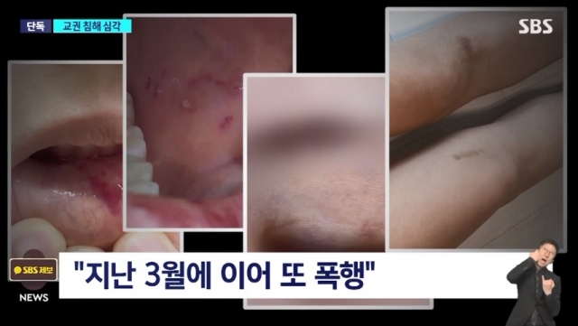 6학년 남학생에게 폭행당한 초등학교 여교사. SBS 보도화면 캡처