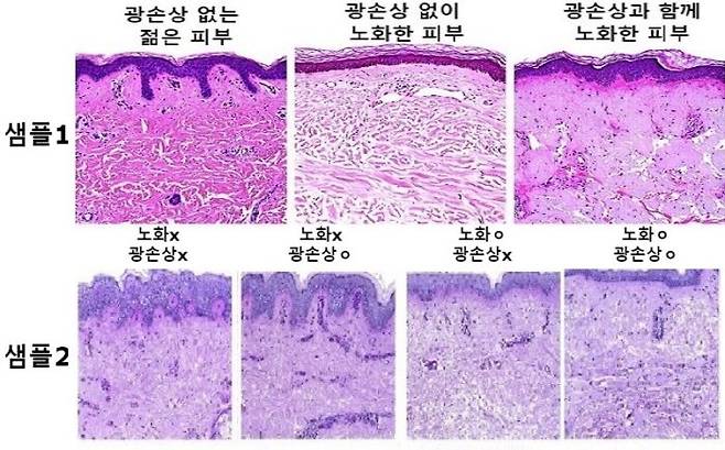 현미경으로 본 피부조직 샘플. 광손상과 노화가 없을수록 피부 두께가 두껍고 내피의 콜라겐 밀도, 피부세포의 형체와 규모가 차이를 보인다. 색상 역시 붉은 빛에서 보랏빛과 회색으로 변한다. [자료=The American Journal of Pathology]
