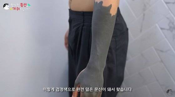 고등학교 1학년 때 친구 어머니에게 '블랙암' 문신 시술을 받았다는 22세 남성 직장인. 사진 '문신 지우는 영수쌤' 유튜브 캡처