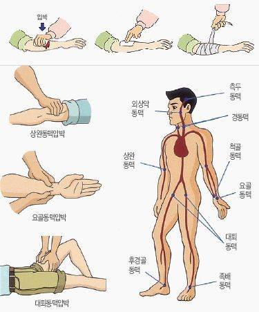 출혈 시 지혈방법 [사진출처=서울종합방재센터]