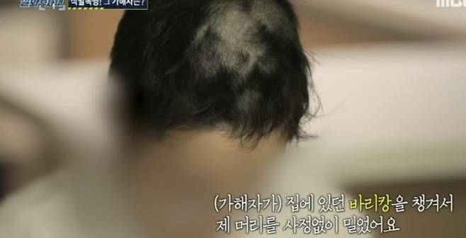 남자친구에게 데이트 폭력을 당한 피해자. (사진=MBC ‘실화탐사대’ 캡처)