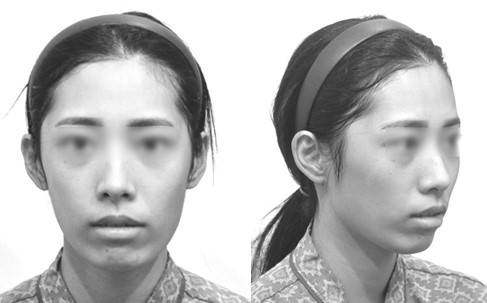 중안면 긴 얼굴.