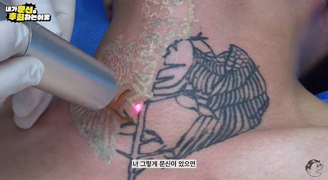 성형외과 전문의 박영수 원장이 한 20대 남성의 목에서 문신을 지우고 있다. 이 남성은 주변 시선과 취업 문제로 문신 제거를 요청했다. /유튜브