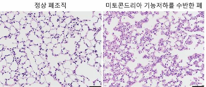 미토콘드리아 기능저하를 가진 쥐의 폐조직은 비정상적인 상태의 폐포조직을 형성하고 있는 것을 확인했다.[노스웨스턴대 제공]