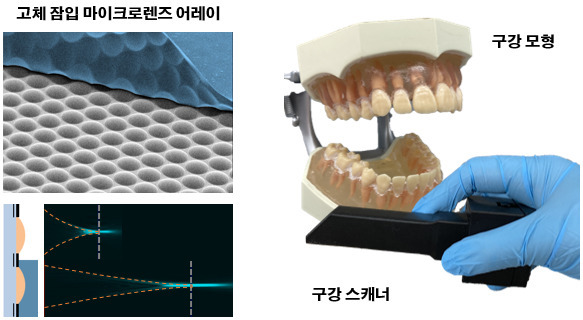 구강 스캐닝용 라이트필드 카메라 제작을 위한 고체 잠입 마이크로렌즈 어레이(왼쪽)와 최종 패키징된 라이트필드 카메라 기반 구강 스캐너 및 구강 모형(오른쪽).[KAIST 제공]