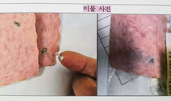 급식용 햄에서 발견한 이물질 [해당 고등학교/연합]